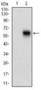 Calcium/Calmodulin Dependent Protein Kinase II Gamma antibody, NBP2-37262, Novus Biologicals, Western Blot image 