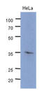 Cyclin Dependent Kinase 4 antibody, MBS200269, MyBioSource, Western Blot image 