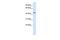 Interleukin-11 receptor subunit alpha antibody, GTX46437, GeneTex, Western Blot image 