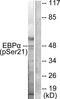 CCAAT Enhancer Binding Protein Alpha antibody, GTX55304, GeneTex, Western Blot image 