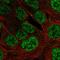 PLAG1 Zinc Finger antibody, HPA072290, Atlas Antibodies, Immunofluorescence image 