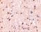 Immunity Related GTPase M antibody, GTX85038, GeneTex, Immunohistochemistry paraffin image 