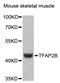 TFAP2B antibody, LS-C748907, Lifespan Biosciences, Western Blot image 