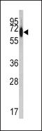 Albumin antibody, LS-C99267, Lifespan Biosciences, Western Blot image 