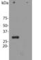 mCherry Tag  antibody, LS-C204826, Lifespan Biosciences, Western Blot image 