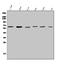 PARP2 antibody, A03270-2, Boster Biological Technology, Western Blot image 