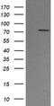 Peptidyl Arginine Deiminase 4 antibody, TA504814S, Origene, Western Blot image 