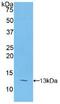 Polymeric Immunoglobulin Receptor antibody, abx103495, Abbexa, Enzyme Linked Immunosorbent Assay image 