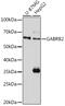 Gamma-Aminobutyric Acid Type A Receptor Beta2 Subunit antibody, GTX54094, GeneTex, Western Blot image 