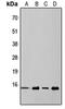 Eukaryotic Translation Initiation Factor 4E Binding Protein 1 antibody, orb304749, Biorbyt, Western Blot image 