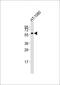 Matrix Metallopeptidase 14 antibody, MBS9200618, MyBioSource, Western Blot image 