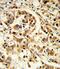 Interleukin 12A antibody, GTX81020, GeneTex, Immunohistochemistry paraffin image 