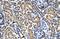 Phosphorylase Kinase Catalytic Subunit Gamma 2 antibody, A07871, Boster Biological Technology, Immunohistochemistry paraffin image 