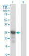 Cyclin Dependent Kinase Inhibitor 1B antibody, LS-B5389, Lifespan Biosciences, Western Blot image 