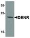 Density Regulated Re-Initiation And Release Factor antibody, LS-C336157, Lifespan Biosciences, Western Blot image 