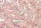 Secreted Frizzled Related Protein 1 antibody, orb125011, Biorbyt, Immunohistochemistry paraffin image 
