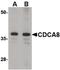 Cell Division Cycle Associated 8 antibody, PA5-20576, Invitrogen Antibodies, Western Blot image 