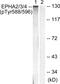 EPH Receptor A2 antibody, PA5-37811, Invitrogen Antibodies, Western Blot image 