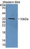 Copper Chaperone For Superoxide Dismutase antibody, LS-C314557, Lifespan Biosciences, Western Blot image 