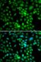 Synaptonemal Complex Central Element Protein 1 antibody, LS-C346392, Lifespan Biosciences, Immunofluorescence image 