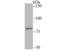 SMAD Specific E3 Ubiquitin Protein Ligase 2 antibody, NBP2-75667, Novus Biologicals, Western Blot image 