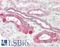 TNF Receptor Superfamily Member 14 antibody, LS-B11171, Lifespan Biosciences, Immunohistochemistry paraffin image 