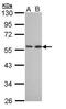 Dipeptidyl Peptidase 7 antibody, PA5-28888, Invitrogen Antibodies, Western Blot image 