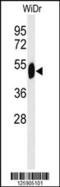 SET Domain Containing 6, Protein Lysine Methyltransferase antibody, 61-683, ProSci, Western Blot image 