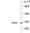 Cyclin Dependent Kinase 5 antibody, LS-C177438, Lifespan Biosciences, Western Blot image 