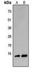 Basic Leucine Zipper ATF-Like Transcription Factor antibody, LS-C354557, Lifespan Biosciences, Western Blot image 