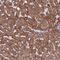 Zinc Finger Protein 248 antibody, HPA018455, Atlas Antibodies, Immunohistochemistry paraffin image 