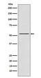 Ribosomal Protein S6 Kinase B2 antibody, M05845, Boster Biological Technology, Western Blot image 