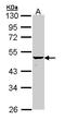 Keratin, type I cuticular Ha4 antibody, LS-B15620, Lifespan Biosciences, Western Blot image 