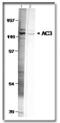 Adenylate Cyclase 3 antibody, PA1-31191, Invitrogen Antibodies, Western Blot image 