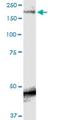 Sodium Voltage-Gated Channel Alpha Subunit 9 antibody, H00006335-M01, Novus Biologicals, Western Blot image 