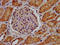 Legumain antibody, LS-C670576, Lifespan Biosciences, Immunohistochemistry paraffin image 