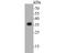 Thioredoxin Related Transmembrane Protein 1 antibody, NBP2-80422, Novus Biologicals, Western Blot image 