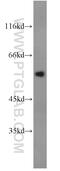 Serpin Family C Member 1 antibody, 16414-1-AP, Proteintech Group, Western Blot image 