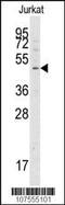 Autophagy Related 4A Cysteine Peptidase antibody, MBS9211692, MyBioSource, Western Blot image 