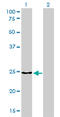 Clathrin Light Chain B antibody, LS-C133126, Lifespan Biosciences, Western Blot image 