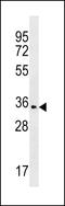 Olfactory Receptor Family 2 Subfamily T Member 35 antibody, LS-C158467, Lifespan Biosciences, Western Blot image 