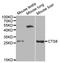 Cystatin 8 antibody, LS-C331365, Lifespan Biosciences, Western Blot image 