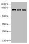 Zinc Finger Protein 614 antibody, A61974-100, Epigentek, Western Blot image 