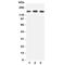 Nuclear Receptor Coactivator 3 antibody, R31401, NSJ Bioreagents, Western Blot image 