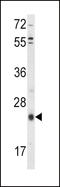 TIMP Metallopeptidase Inhibitor 3 antibody, LS-C161892, Lifespan Biosciences, Western Blot image 