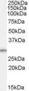 TPD52 Like 2 antibody, PA5-18797, Invitrogen Antibodies, Western Blot image 