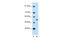 Amyloid Beta Precursor Protein Binding Family A Member 1 antibody, 31-125, ProSci, Immunohistochemistry paraffin image 