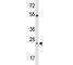 Cytotoxic T-Lymphocyte Associated Protein 4 antibody, F51730-0.4ML, NSJ Bioreagents, Western Blot image 
