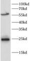 Peroxisome Proliferator Activated Receptor Delta antibody, FNab10132, FineTest, Western Blot image 