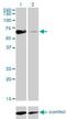 Nuclear Receptor Subfamily 1 Group D Member 2 antibody, H00009975-M01, Novus Biologicals, Western Blot image 